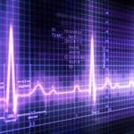 Acupuncture improves cardiac coherence